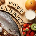 Food Allergies: Causes, Symptoms, and How to Manage Them