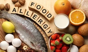 Food Allergies: Causes, Symptoms, and How to Manage Them